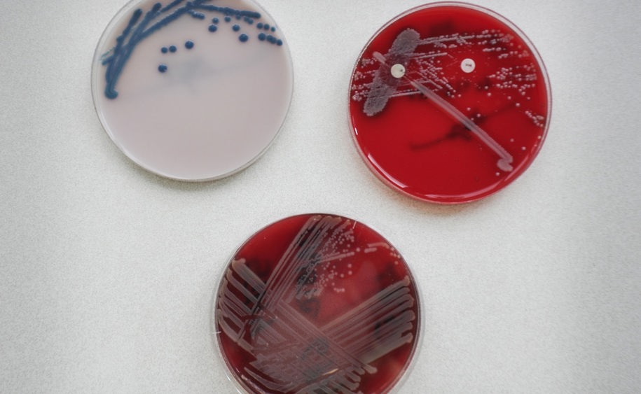 Klinická mikrobiologie